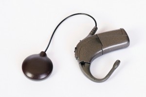 Cochlear Implant Vail AZ